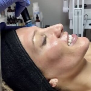 HydraFacial MD®