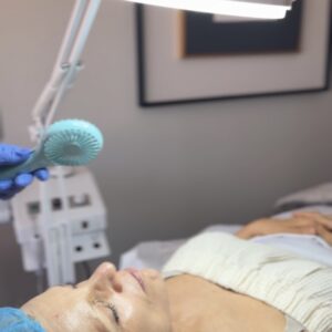 MicroPeel