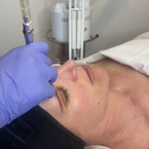 Microdermabrasion